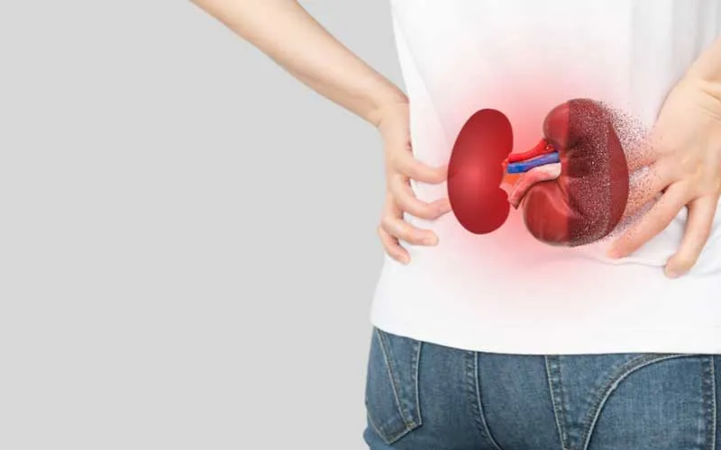 chronic-kidney-disease-ckd at dial a dialysis centre